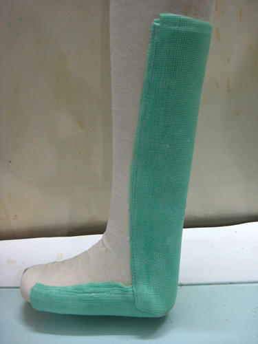 医用高分子夹板-可耐特_医用_用高_高分_分子